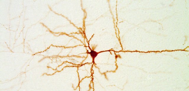 Mikroskopiebild einer Nervenzellen