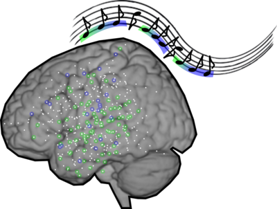 Noten und deren Repräsentation im Gehirn