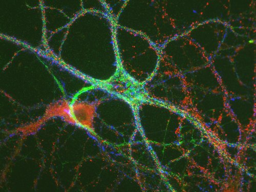 Some nerve cells carry very pronounced ECM nets (green), which surround excitatory (red) and inhibitory (blue) synapses (for details see John et al., MCN 2006).   