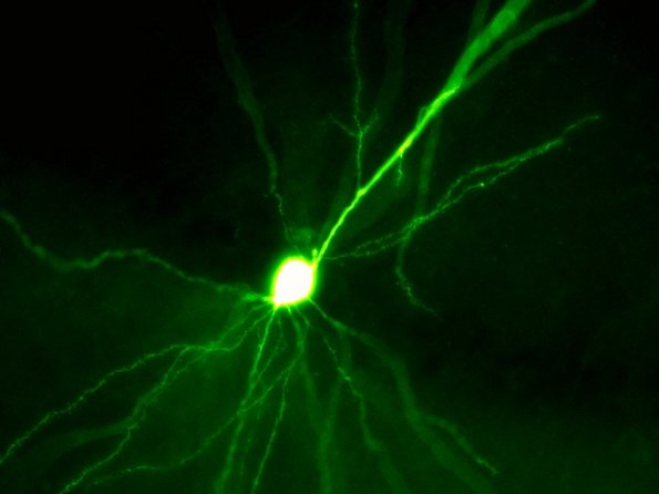 Nervenzelle unter dem Mikroskop