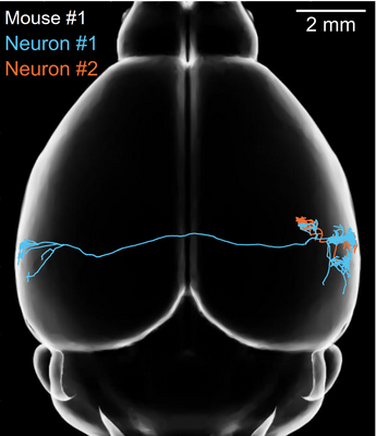 2 Nervenzellen und ihre Errregungsleitungen im Gehirn
