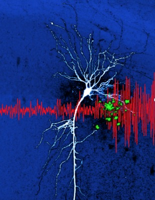 Preprint "Hippocampal hyperactivity in a rat model of Alzheimer’s disease".   This illustration shows amyloid deposits (in green) in the vicinity of a CA1 pyramidal neuron. The deposition of beta amyloid is a hallmark of human Alzheimer’s disease. In our work (Sosulina et al. bioRxiv 2020, Siskova et al. Neuron 2014) we discovered new pathomechanisms of how neurons change their excitability in the presence of amyloid beta.  On the network level these changes result in aberrant patterns of oscillations ( in the local field potential, in red).